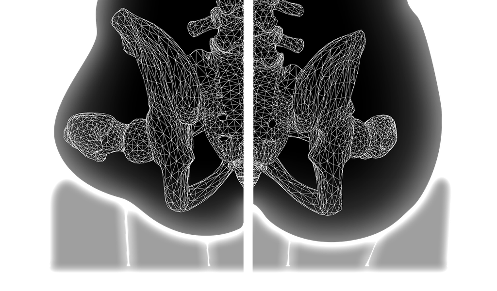 Axiom Air LTE air cushion cells on a wheelchair seat