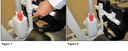 Fitting the SGA-440 knee pad assembly into the height adjustment rod